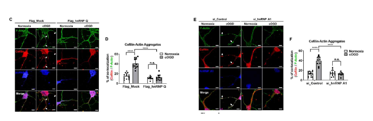 Cofilin-actin rod 형성 저해작용 분석 (adapted from Jung et al. Sci Adv 2020)