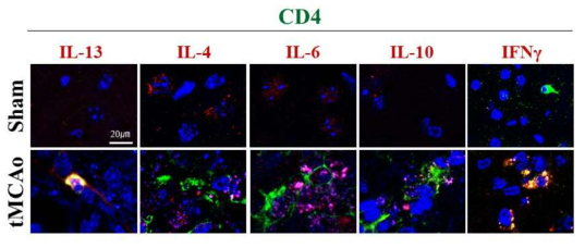 뇌졸중(tMCAO) 후 1주일에 immunofluorescent staining(형광염색)으로 선조체의 CD4+ T 세포에서 발현하는 면역인자 분석
