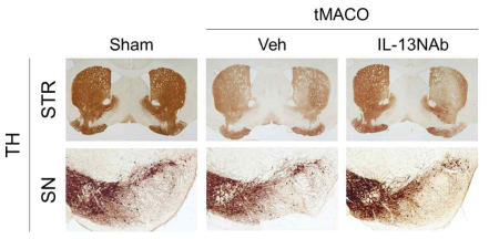 뇌졸중(tMCAO) 후 IL-13 중화항체 (IL-13NAb)의 선조체-흑질 도파민 신경세포 보호 효과를 TH immunohistochemical stainign으로 분석