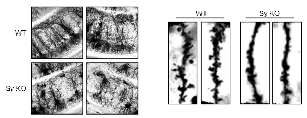 Sy KO 성체 마우스 해마 조직에서 수상돌기의 수가 감소