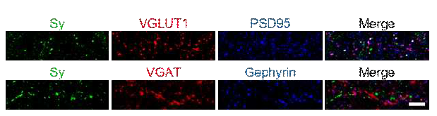 Endogenous Sy는 배양된 신경세포에서 흥분성 시냅스 전시냅스 및 후시냅스에 위치함