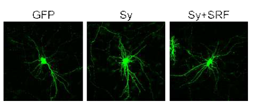 SRF를 보충함(rescue)에 의해 Sy 과발현으로 인한 가지돌기 구조의 변형을 회복함을 증명