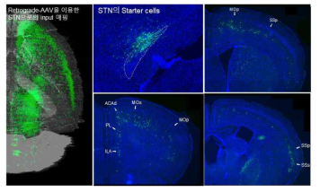 ZsGreen transgenic mouse에서 역행성 AAV를 이용한 Retrograde tracing