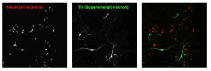 배양된 mouse 도파민 신경세포