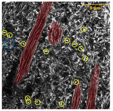 쥐 뇌 조직의 해마 구조에서 actin filament 구조 파란색 원: actin ring, 노란색 원: post synaptic actin, 붉은색 표시: dendrite. 모든 Scale bars는 팽창 전 기준