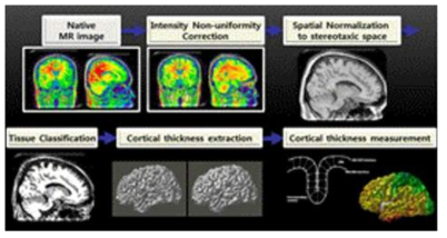 fMRI 및 포도당 대사, GABA 및 Glutamate 신경영상 획득
