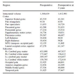 수술 전후 MR volumetry 분석