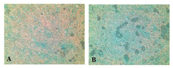 배양액 차이에 따른 분화의 차이 (alcian blue staining, A: Alpha MEM B: B-ALITM Bronchial Air-Liquid Interface Medium BulletKit, Lonza, swirzerland). 분화배지에서 goblet cells 에서의 mucin이 분화배지에서 더 잘 관찰되는 것을 확인함