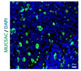 제작된 호흡기 점막 오가노이드에서 점액 분비 세포의 변화 (MUC5AC : green / DAPI : blue) (scale bar : 20 μm)