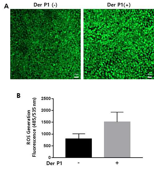 oxidative stress 지표(ROS) 변화 측정. confocal microscopy (A), fluorometer 측정 값 (B)