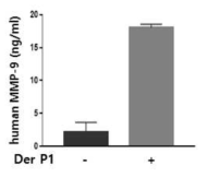 집먼지 진드기 처리 유무에 따른 metalloprotein 분비 검사