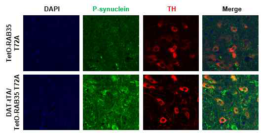 RAB35 T72A 과발현 mouse 뇌속 흑질 내 synuclein phosphorylation 분석