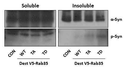 Rab35 WT, T72A, 및 T72D에 의한 α-synuclein 인산화 변화를 분석