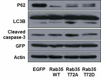 Rab35 과별현 이후 신경 내 autophagy 관련 marker 단백질 발현 변화 분석