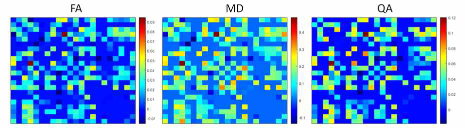 3T 및 7T 기저핵 연결에서 FA, MD, QA의 유의미한 평균 차이