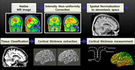 fMRI 및 포도당 대사, GABA 및 Glutamate 신경영상 획 득