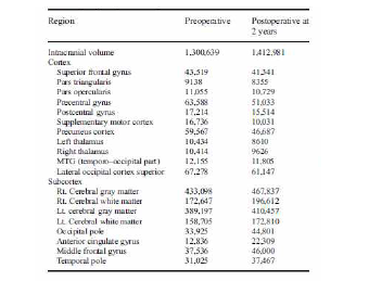 수술 전후 MR volumetry 분석