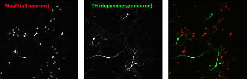 배양된 mouse 도파민 신경세포