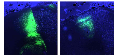 대뇌피질에서 CaMKII 발현 신경세포에 발현된 GCaMP (좌: K_FP_#1 Mouse, 우: K_FP_#2 Mouse)