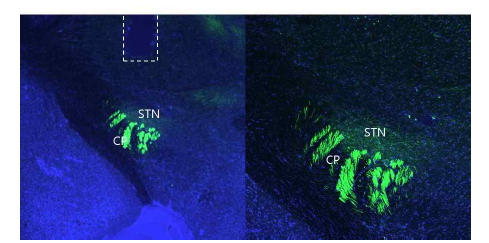 대뇌피질로부터 시상하핵으로 연결되는 시냅스와 광섬유 광도측정 위치 (K_FP_#2 Mouse)