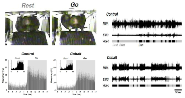 조현병 쥐 모델에서 외측 중간돌기세포의 In vivo MUA 측정과 EMG 측정 예시