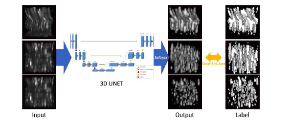 3차원 U-Net 신경망의 학습 개요