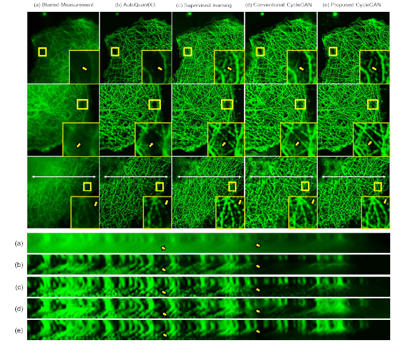 Monkey Kidney Fibroblasts 영상에 적용된 Deconvolution 기법 비교