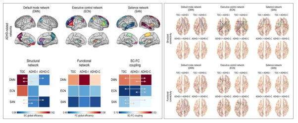 ADHD 관련 뇌연결망에서구조적/기능적 연결망의 전역효율성과 구조-기능 커플링의 그룹간 차이. (a)ADHD관련 뇌 연결망, (b)구조적 연결성 분석, (c)기능적 연결성 분석, (d)구조-기능 연결망 비교