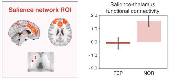 첫 발병 정신증 환자에서 salience network와 ventrolateral/ventroposterior thalamus의 감소된 연결성