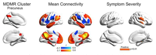 망상증상척도와 연관되는 휴지기 네트워크 연결성 뇌부위