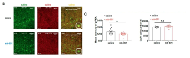 면역조직화학 (IHC)를 통해서 pPKA 염색 발현양이 parvalbumin 발현 억제성 신경세포에서 감소됨을 분석