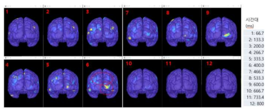 Posner task 수행 시 단일시행 뇌파로 학습된 3D CNN 학습모델의 LRP 분석 결과 시간대별 relevance 점수 분포도(높은 점수일수록 노란색)