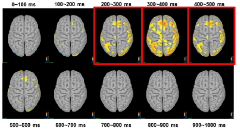 주의력 작업 수행 시 단일시행 뇌파로 학습된 3D CNN 학습모델의 LRP 분석 결과 시간대별 relevance 점수 분포도(높은 점수일수록 노란색)