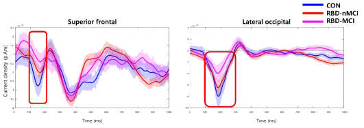 iRBD-MCI와 iRBD-nonMCI 간 relevance 점수 패턴에 차이를 보이는 영역에서의 ERCD 파형 비교 (좌) superior frontal (우) lateral occipital