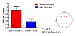 RLS 환자의 치료 전/후 P200 relative change 비교