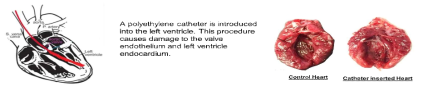 Schematic diagram of Left Ventricular Thrombus Animal Model