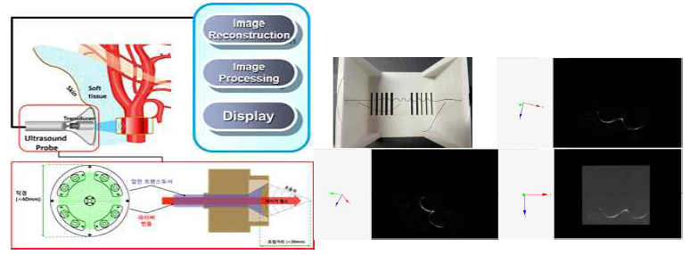 3D 광음향 영상시스템 개략도(왼쪽), 시스템을 이용한 팬텀 및 실험결과(오른쪽)