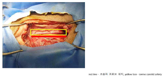 광음향 영상을 획득하기 위한 실험 구성