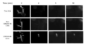 24 hr Post Imaging with targeted bio-imaging agent (CREKA-Micelle), non-targeted bio-imaging agent (non CREKA-Micelle), and free infra-red dye, ICG