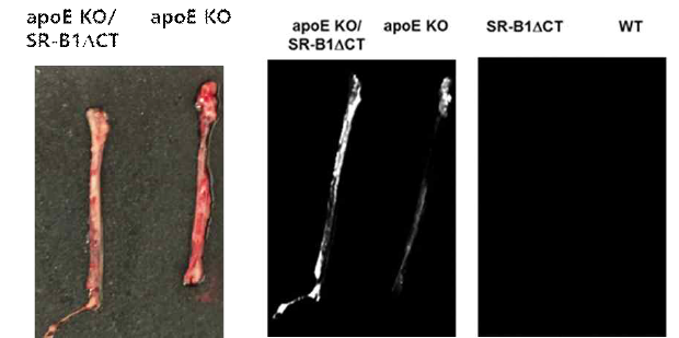 Ex vivo image of the thoracic aorta of mice. Top image is pathologic specimen. Bottom images are NIR image after thrombus targeted bio-imaging agent