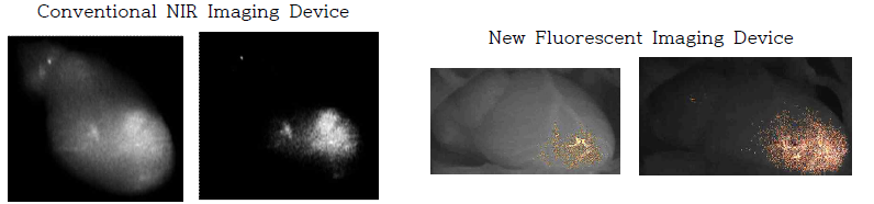 Visualization of left ventricular thrombosis using conventional NIR imaging device and the new fluorescent imaging device