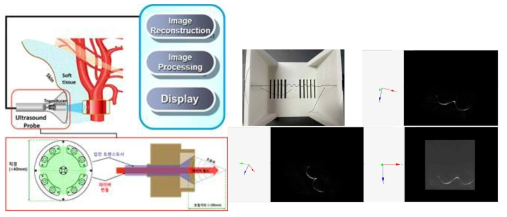 3D 광음향 영상시스템 개략도(왼쪽), 시스템을 이용한 팬텀 및 실험결과(오른쪽)