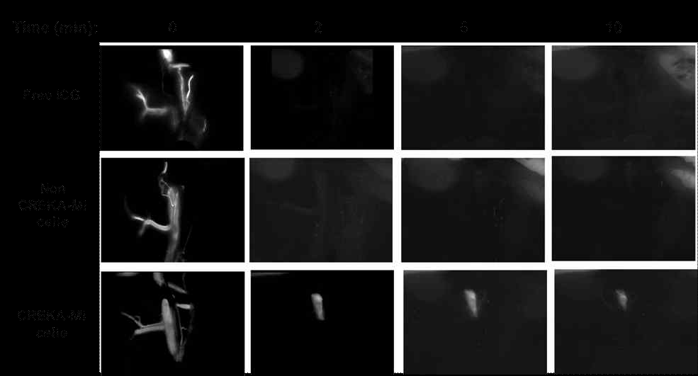 24 hr Post Imaging with targeted bio-imaging agent (CREKA-Micelle), non-targeted bio-imaging agent (non CREKA-Micelle), and free infra-red dye, ICG