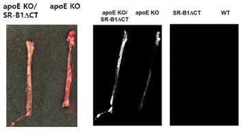 Ex vivo image of the thoracic aorta of mice. Top image is pathologic specimen. Bottom images are NIR image after thrombus targeted bio-imaging agent