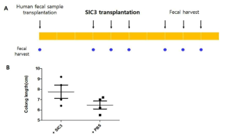 IBD 환자 분변 이식 후 SIC3의 영향