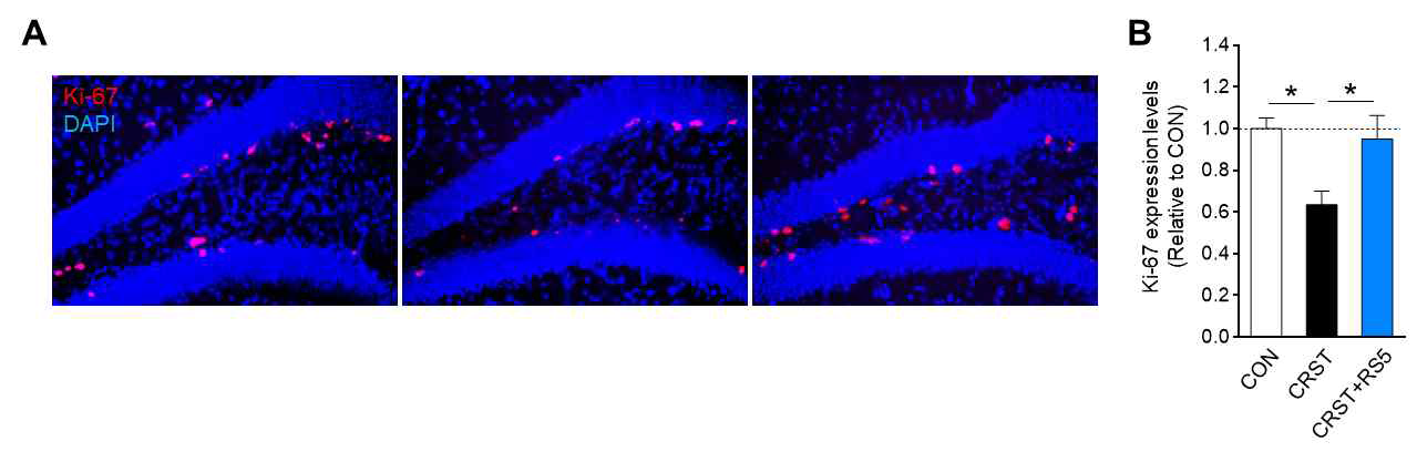성인 마우스의 해마 지역에서 만성스트레스 및 RS5에 의한 Ki-67 발현 변화 탐지 (미발표데이터)