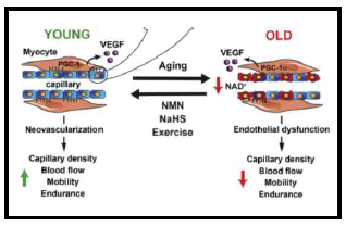 혈관 노화에 따른 NAD+ 감소 및 내피세포 기능 장애