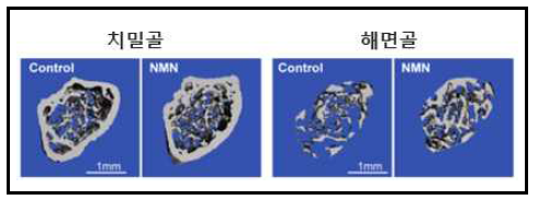 NMN 보충에 따른 골다공증 개선 효과