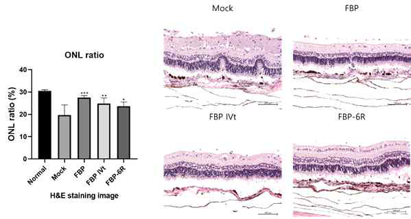 H&E 염색에 의한 ONL ratio