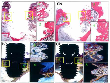 Histological images of tissue after 8 week implantation where (a)Ti64/SA implants and (b) Ti64/7ions implants. (c and d) the newly formed bone around the surfaces of implants